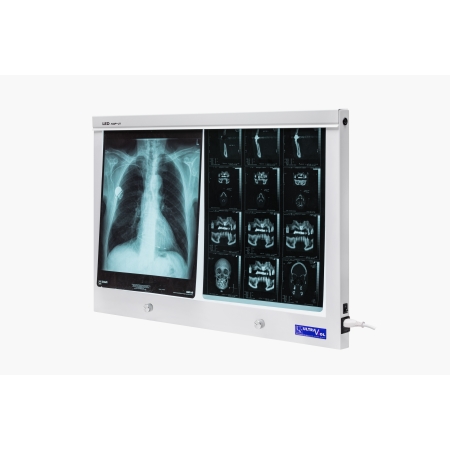 Negatoskop LED NGP 21